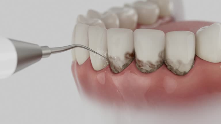 Reliable Wisdom Tooth Removal contractor in Rankin County County, MS by Dentist Open Now